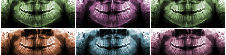 panoramikes exetaseis
