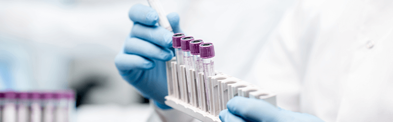 Μοριακή Διάγνωση Κορωνοϊού